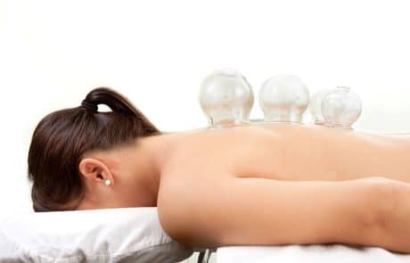 Cupping Therapy