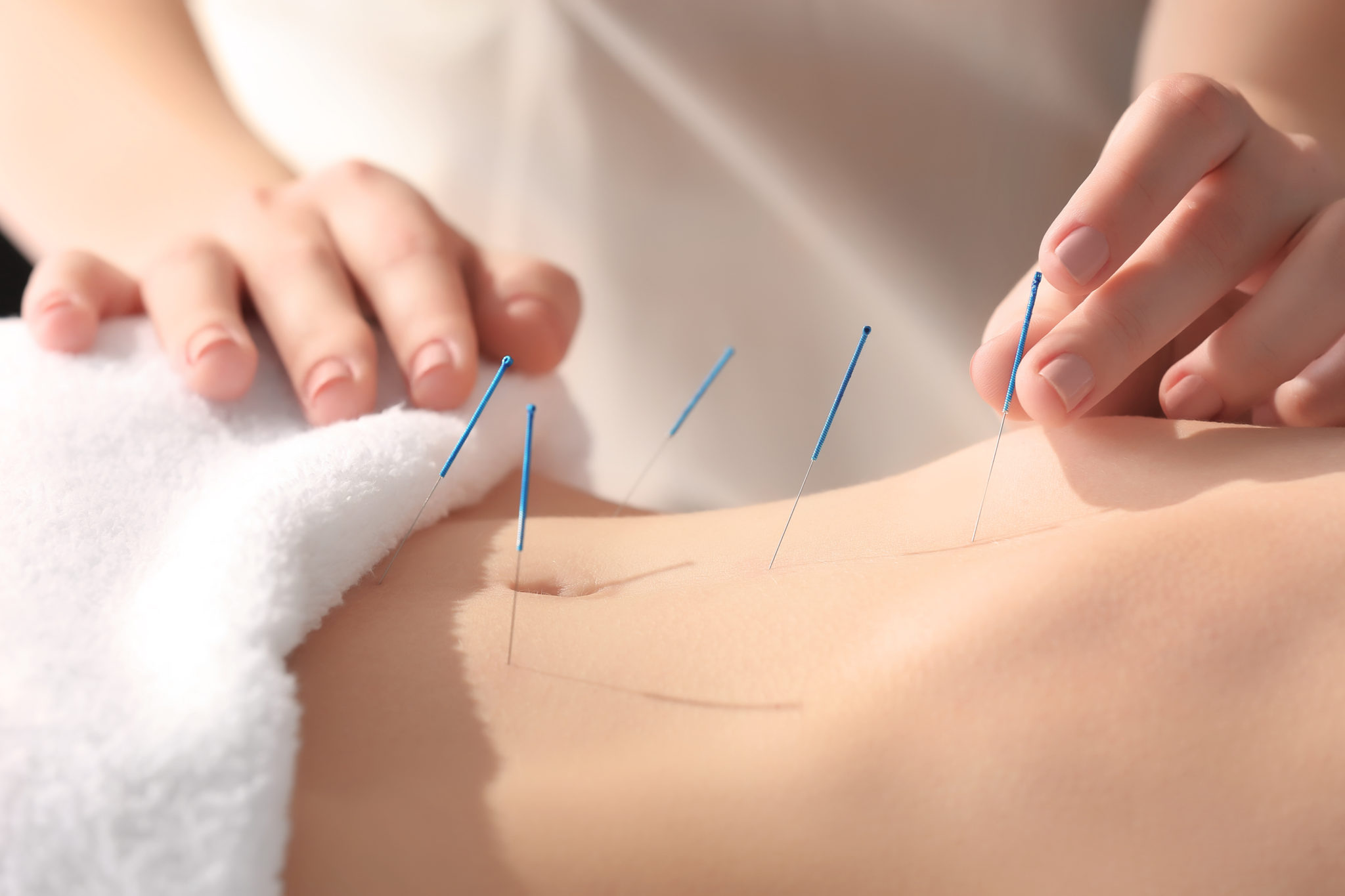 acupuncture help with bloating