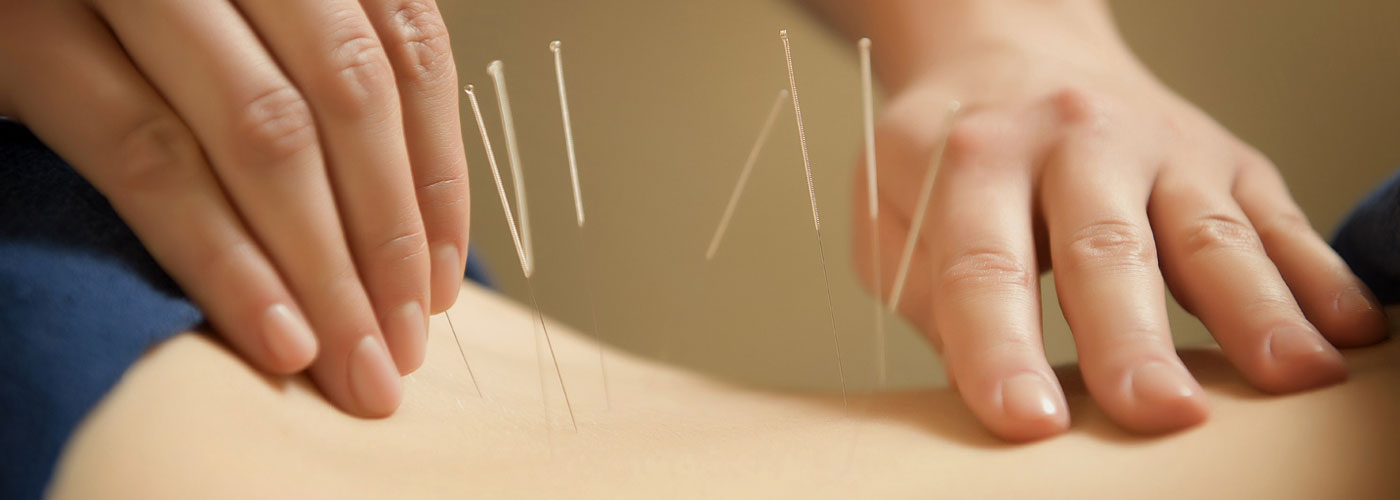 Benefits of Acupuncture for Pain Management – Aster Chinese Medicine