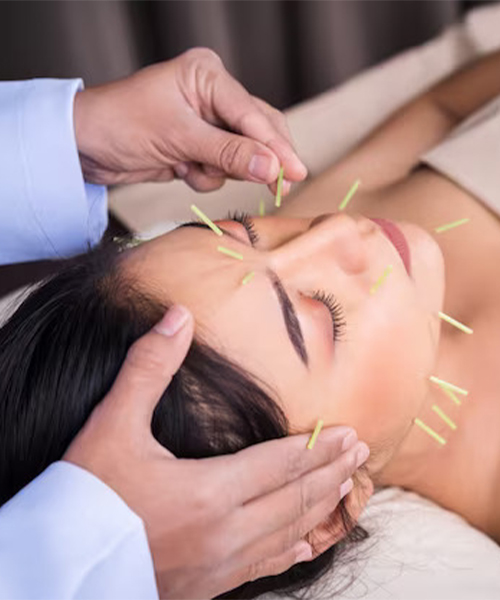 Cosmetic Acupuncture Treatment