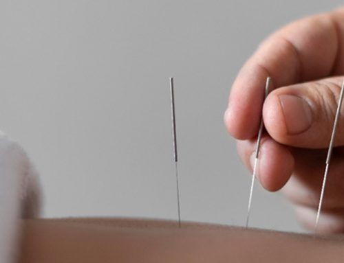 Acupuncture Aftercare