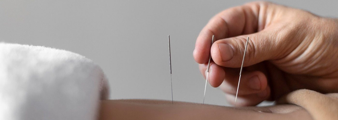 Aftercare Acupuncture Therapy