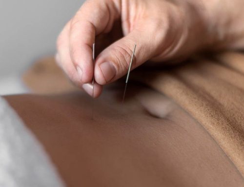 How Much Does Acupuncture Cost?