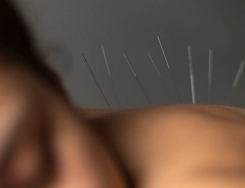 How Does Acupuncture Work to Relieve Pain?